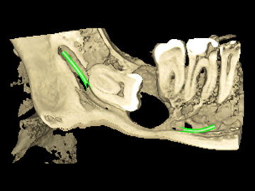 Imágenes 3D • Cone Beam