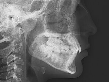 Imágenes 2D - Telerradiografía Frontal y Lateral de Cráneo