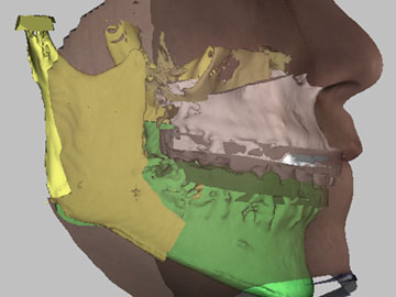 Dolphin 3D